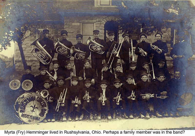band -2